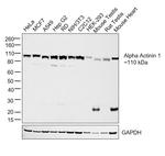 alpha Actinin 1 Monoclonal Antibody (0.T.02)