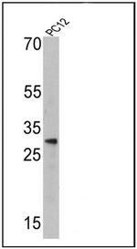 Endothelin 1 Antibody in Western Blot (WB)