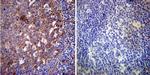 HSP70 Antibody in Immunohistochemistry (Paraffin) (IHC (P))
