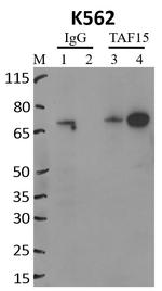 TAF15 Antibody in RNA Immunoprecipitation (RIP)