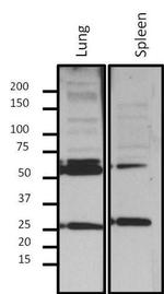 Lamin A/C Antibody in Western Blot (WB)