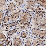 MGMT Antibody in Immunohistochemistry (Paraffin) (IHC (P))