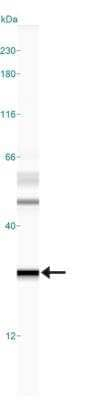 MGMT Antibody in Western Blot (WB)