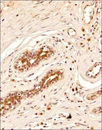 BRIP1 Antibody in Immunohistochemistry (Paraffin) (IHC (P))
