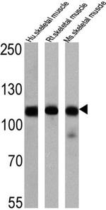 SERCA1 ATPase Antibody in Western Blot (WB)