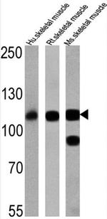 SERCA1 ATPase Antibody in Western Blot (WB)