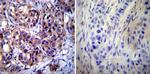 Calpastatin Antibody in Immunohistochemistry (Paraffin) (IHC (P))