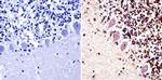 PARP1 Antibody in Immunohistochemistry (Paraffin) (IHC (P))
