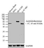 Acetylcholinesterase Antibody in Western Blot (WB)