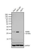 RAB9 Antibody in Western Blot (WB)