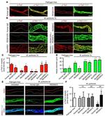 CD31 Antibody in Immunohistochemistry (IHC)