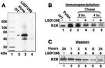 RXRB Antibody in Western Blot (WB)