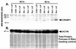 CRABP1 Antibody in Western Blot (WB)