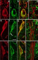 SERCA2 ATPase Antibody in Immunocytochemistry (ICC/IF)