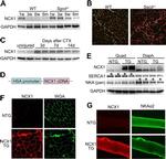 SERCA1 ATPase Antibody in Western Blot (WB)