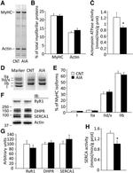 SERCA1 ATPase Antibody in Western Blot (WB)