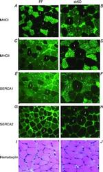 SERCA1 ATPase Antibody in Immunocytochemistry (ICC/IF)