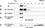 SERCA1 ATPase Antibody in Western Blot (WB)