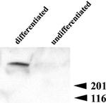 Ryanodine Receptor Antibody in Western Blot (WB)