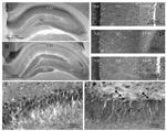 Ryanodine Receptor Antibody in Immunohistochemistry (IHC)