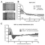 Ryanodine Receptor Antibody in Immunohistochemistry (IHC)