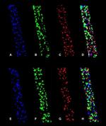 Ryanodine Receptor Antibody in Immunohistochemistry (IHC)