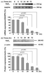 RyR1 Antibody in Western Blot (WB)