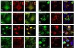RyR1 Antibody in Immunocytochemistry (ICC/IF)