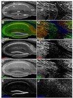 RyR1 Antibody in Immunohistochemistry - Free Floating (IHC (Free))