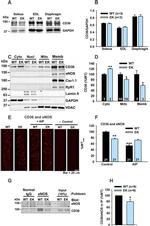 RyR1 Antibody in Western Blot (WB)