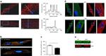 RyR1 Antibody in Immunocytochemistry (ICC/IF)
