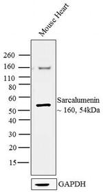 Sarcalumenin Antibody in Western Blot (WB)