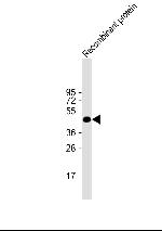 Vaccinia Virus H1L Monoclonal Antibody (20CT26.44.10.3 / 20CT26.44.10.14)