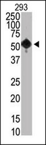 SETD8 Monoclonal Antibody (43AT890)