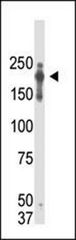 PRDM2 Monoclonal Antibody (33AT1045)