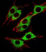 PINK1 Monoclonal Antibody (38CT18.2.6.12)