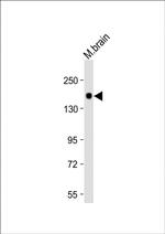 LRRK2 Monoclonal Antibody (133AT720)