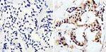 MUC1 Antibody in Immunohistochemistry (Paraffin) (IHC (P))