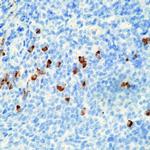 Human IgA (Heavy chain) Secondary Antibody in Immunohistochemistry (Paraffin) (IHC (P))