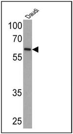 Human IgA (Heavy chain) Secondary Antibody in Western Blot (WB)