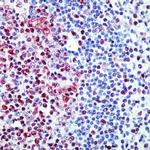 E2F4 Antibody in Immunohistochemistry (Paraffin) (IHC (P))