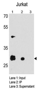 CDK5 Antibody in Immunoprecipitation (IP)