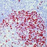 Cyclin A Antibody in Immunohistochemistry (IHC)