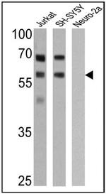p57 Kip2 Antibody in Western Blot (WB)