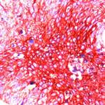GLUT1 Antibody in Immunohistochemistry (IHC)