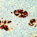 Adenovirus Type 2/5 Antibody in Immunohistochemistry (Paraffin) (IHC (P))