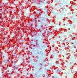 CD2 Monoclonal Antibody (AB75)