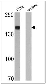 CD13 Antibody in Western Blot (WB)