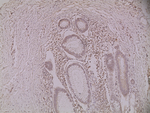 Rb Antibody in Immunohistochemistry (Paraffin) (IHC (P))