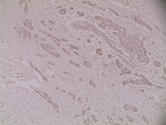 Rb Antibody in Immunohistochemistry (Paraffin) (IHC (P))
